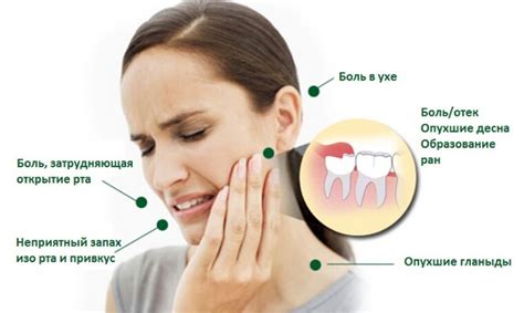 Боль в челюстном суставе при прорезывании зуба мудрости